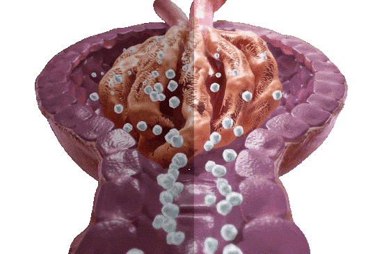 ΤΙ ΕΙΝΑΙ ΛΕΥΚΩΜΑΤΟΥΡΙΑ