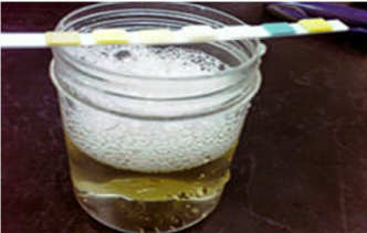 ΛΕΥΚΩΜΑΤΟΥΡΙΑ