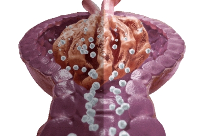 ΛΕΥΚΩΜΑΤΟΥΡΙΑ