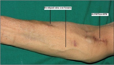 ΑΓΓΕΙΑΚΗ ΠΡΟΣΠΕΛΑΣΗ